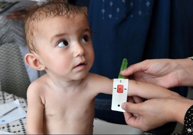 niedozywienie dzieci